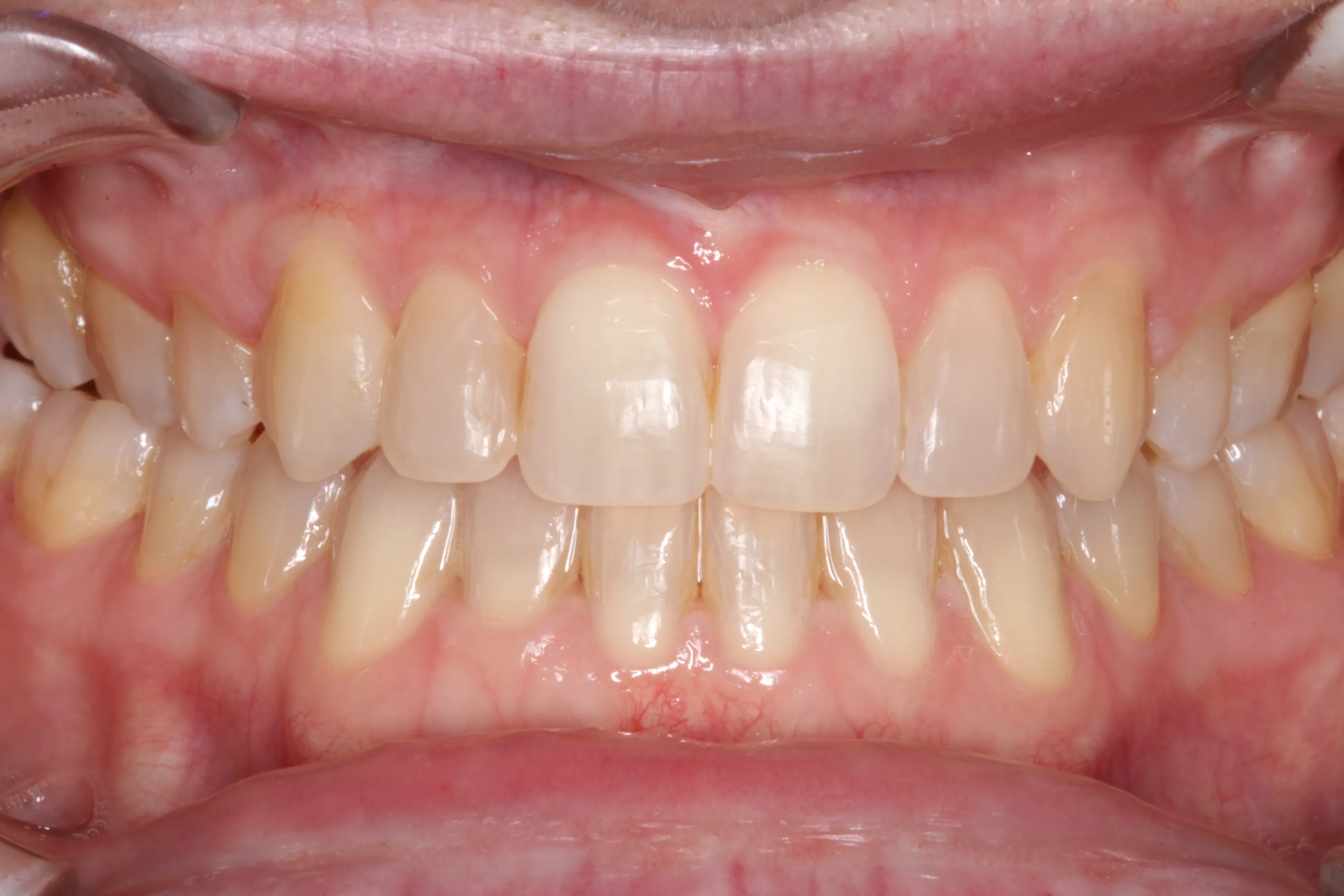 smile-gallery gallery